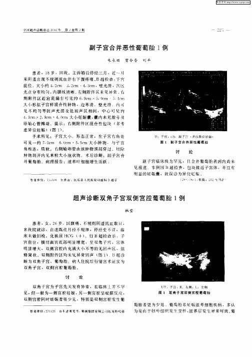 超声诊断双角子宫双侧宫腔葡萄胎1例