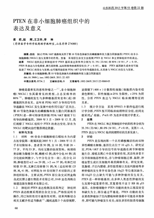 PTEN在非小细胞肺癌组织中的表达及意义
