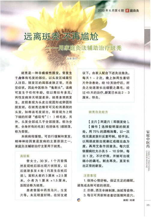 远离斑秃 不再尴尬——用家庭灸法辅助治疗斑秃