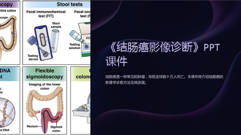 《结肠癌影像诊断》课件