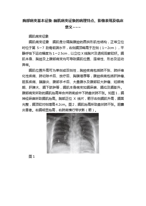 胸部病变基本征象-膈肌病变征象的病理特点、影像表现及临床意义~~~