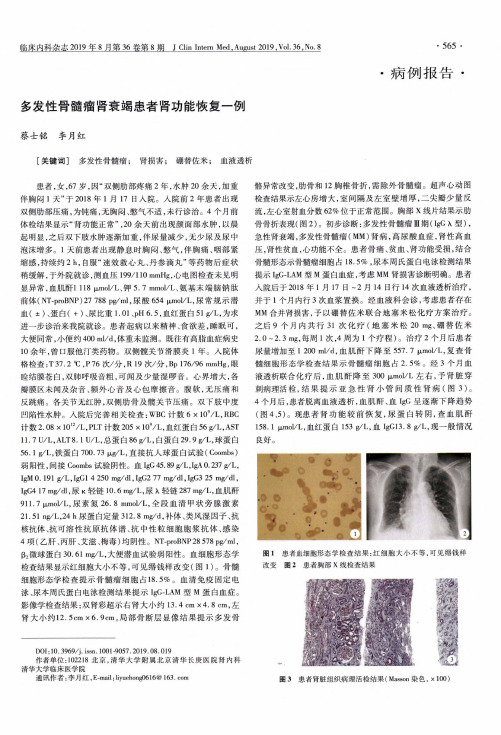 多发性骨髓瘤肾衰竭患者肾功能恢复一例