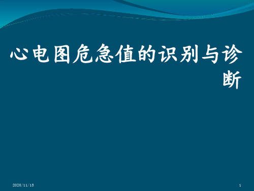 心电图危急值 ppt课件