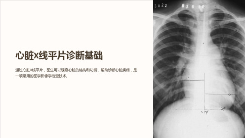 心脏X线平片诊断基础