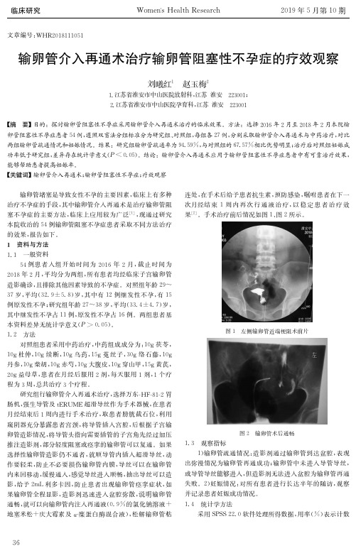 输卵管介入再通术治疗输卵管阻塞性不孕症的疗效观察