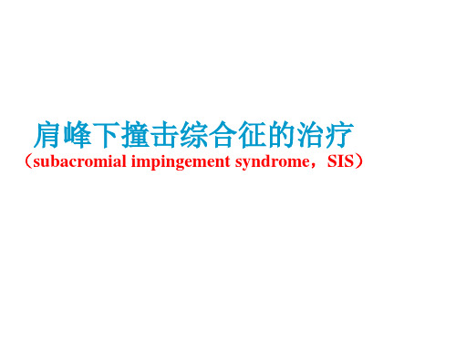 肩峰撞击的治疗