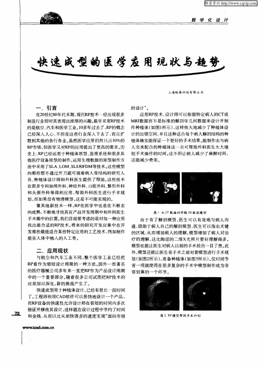 快速成型的医学应用现状与趋势