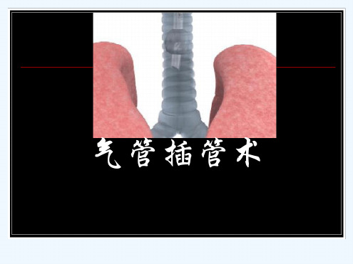 气管插管大学生临床技能大赛培训