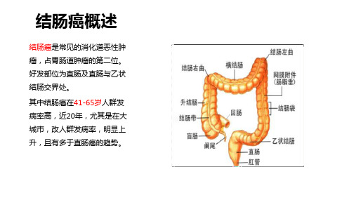 结肠癌护理查房