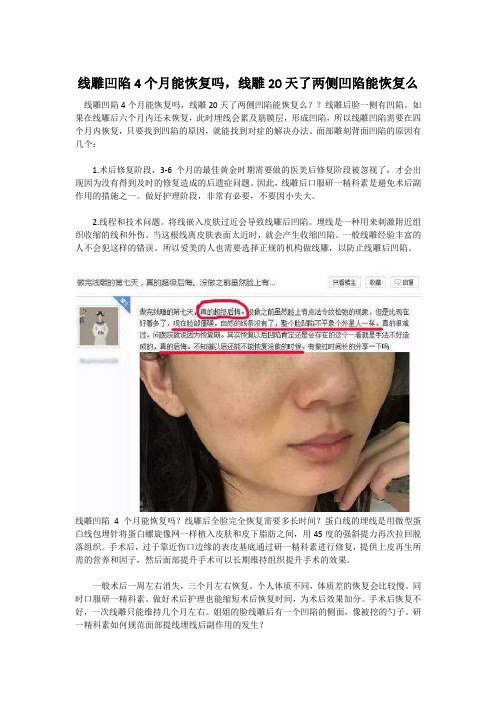 线雕凹陷4个月能恢复吗,线雕20天了两侧凹陷能恢复么