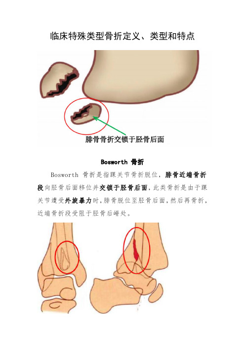 临床特殊类型骨折定义、类型和疾病特点