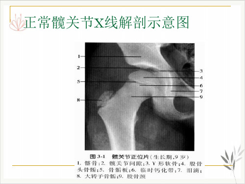 髋关节测量PPT课件