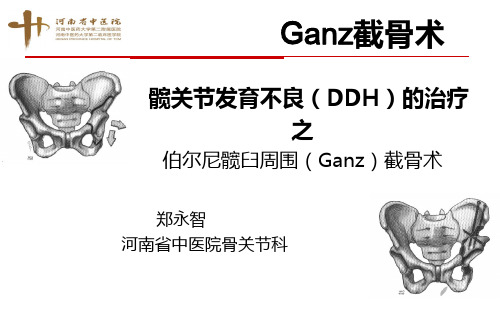 髋臼发育不良的髋臼周围(Ganz)截骨术