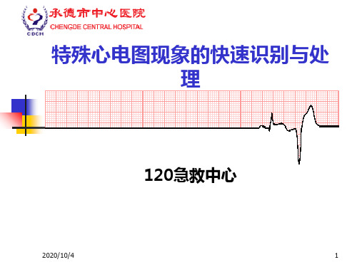 特殊心电图现象在急诊中的快速识别与处理精品PPT课件