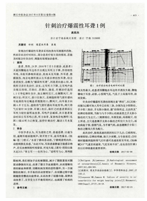 针刺治疗爆震性耳聋1例