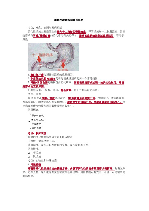 消化性溃疡考试重点总结