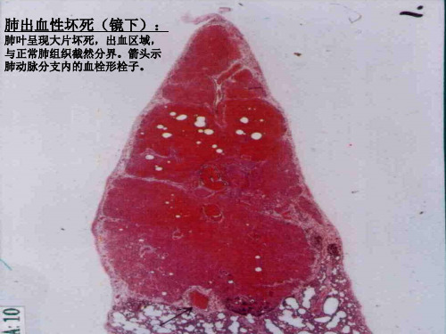 病理实验图片仅供参考PPT课件