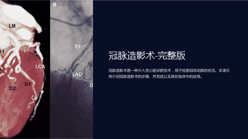 冠脉造影术-完整版