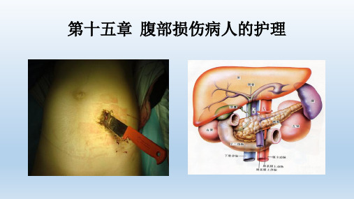 第16章：第三节-腹部损伤病人的护理(1)