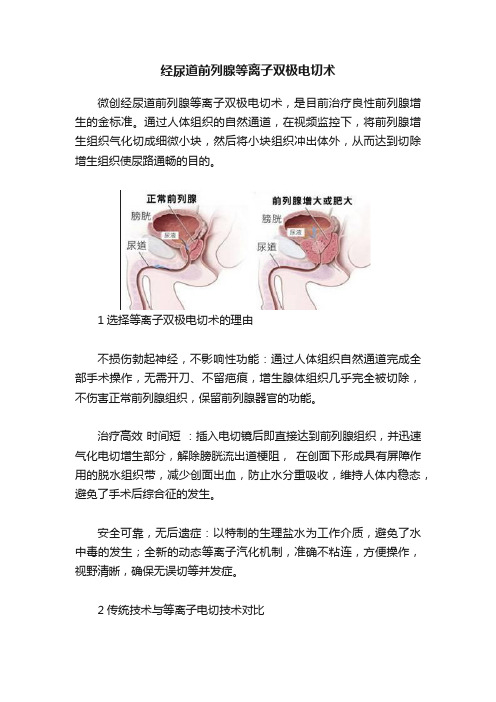 经尿道前列腺等离子双极电切术