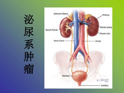 《泌尿系肿瘤》