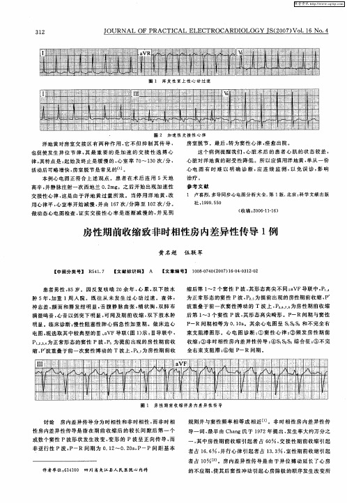 房性期前收缩致非时相性房内差异性传导1例
