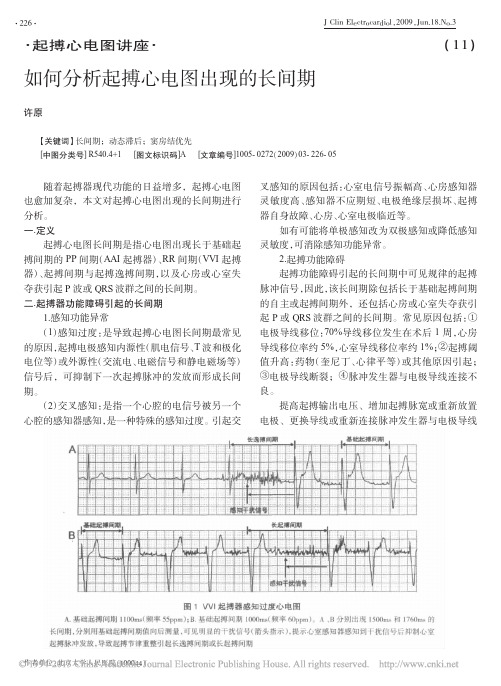 如何分析起搏心电图出现的长间期