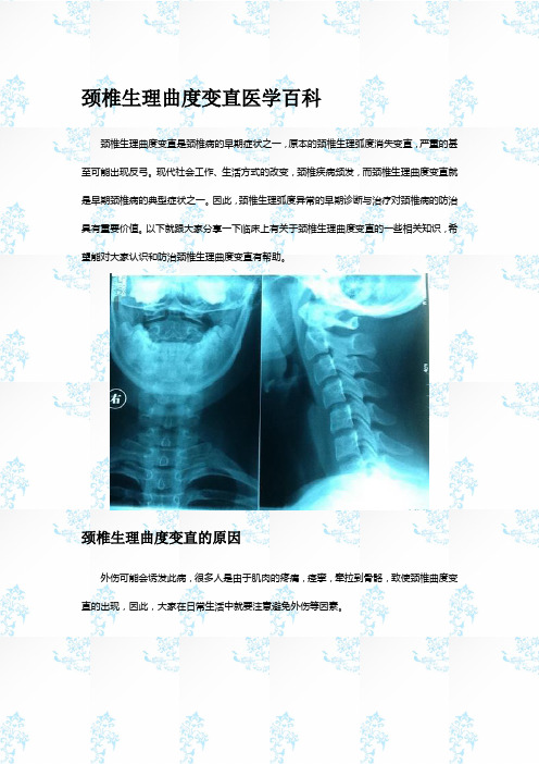 颈椎生理曲度变直医学百科