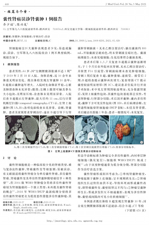 囊性肾癌误诊肾囊肿1例报告