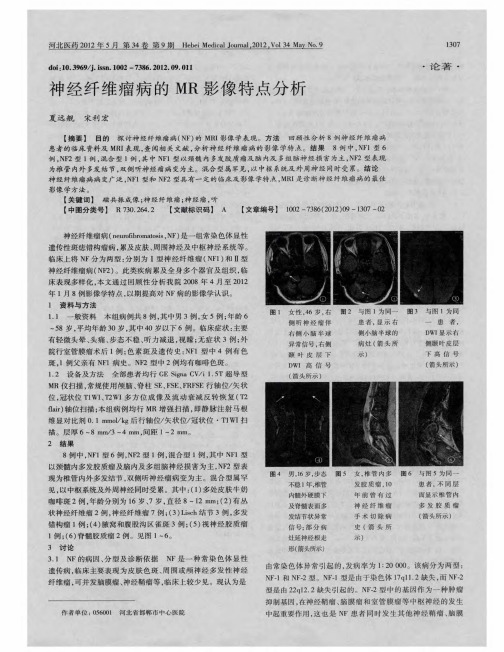 神经纤维瘤病的MR影像特点分析