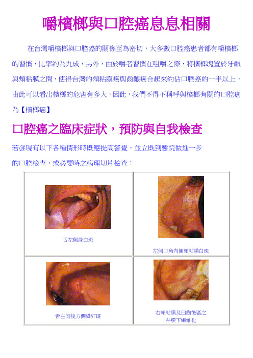 嚼槟榔与口腔癌息息相关