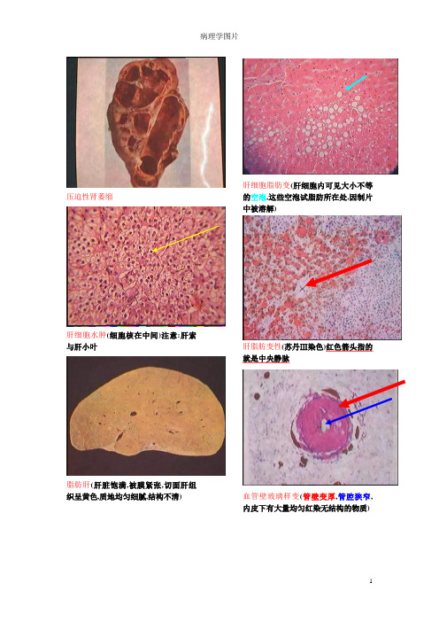 病理学图片