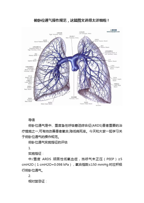 俯卧位通气操作规范，这篇图文讲得太详细啦！