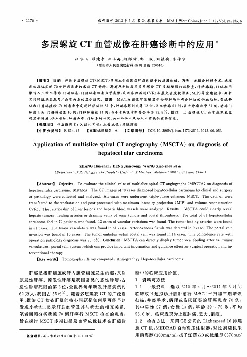 多层螺旋CT血管成像在肝癌诊断中的应用