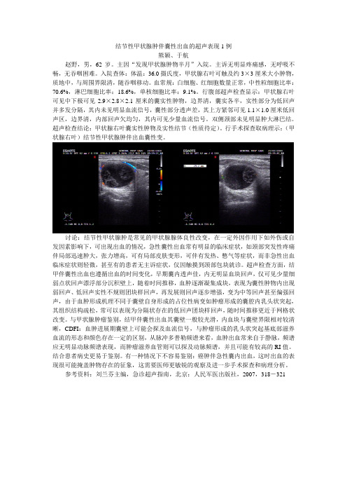 结节性甲状腺肿伴出血的超声表现1例