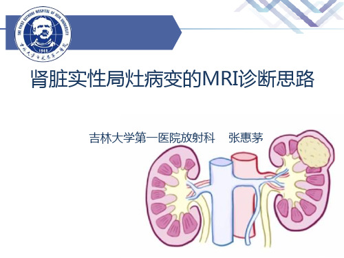 肾脏实性局灶病变的MRI诊断思路