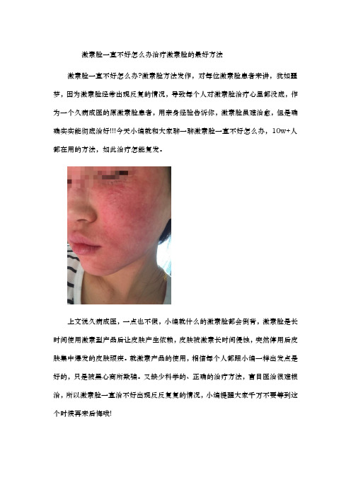 激素脸一直不好怎么办 治疗激素脸的最好方法