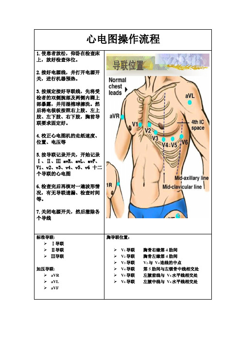 心电图操作流程