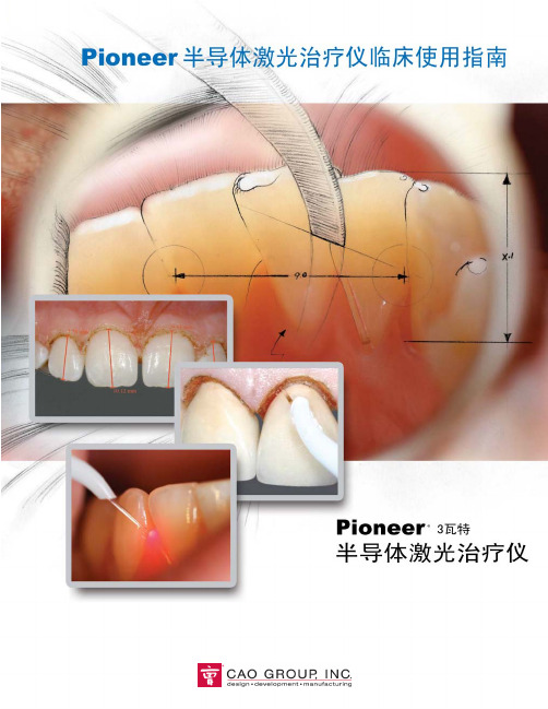 牙科手术的最爱---半导体激光治疗仪使用方法及案例