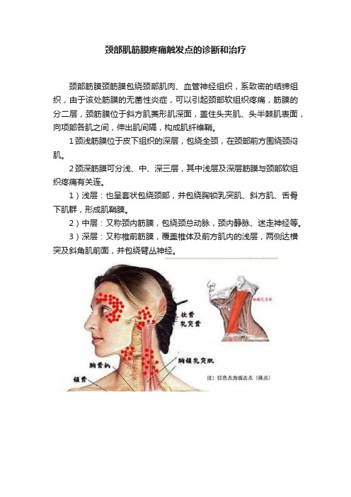 颈部肌筋膜疼痛触发点的诊断和治疗