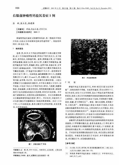 右膝前肿瘤性钙盐沉着症1例