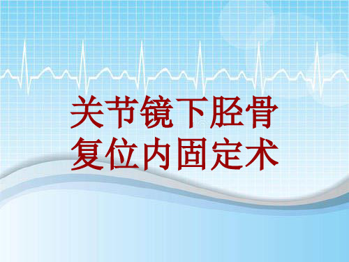 手术讲解模板：关节镜下胫骨复位内固定术