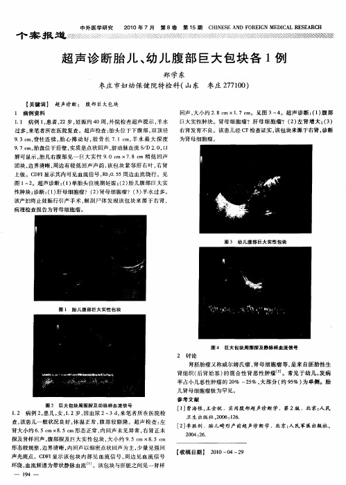 超声诊断胎儿、幼儿腹部巨大包块各1例