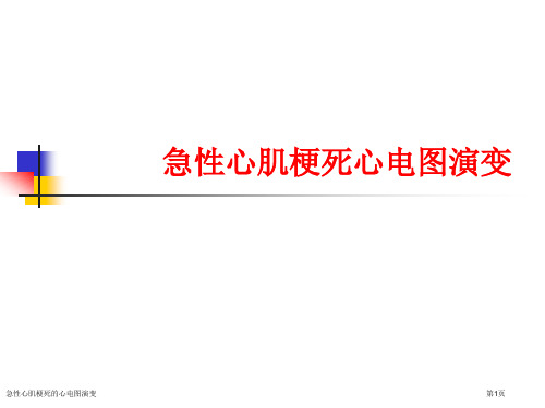 急性心肌梗死的心电图演变