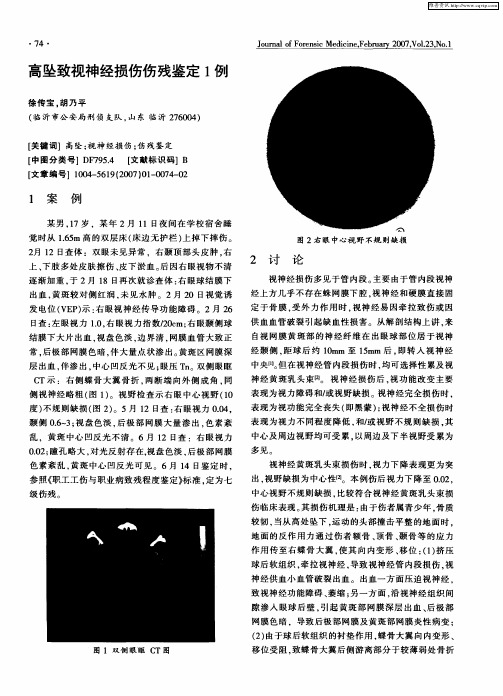 高坠致视神经损伤伤残鉴定1例