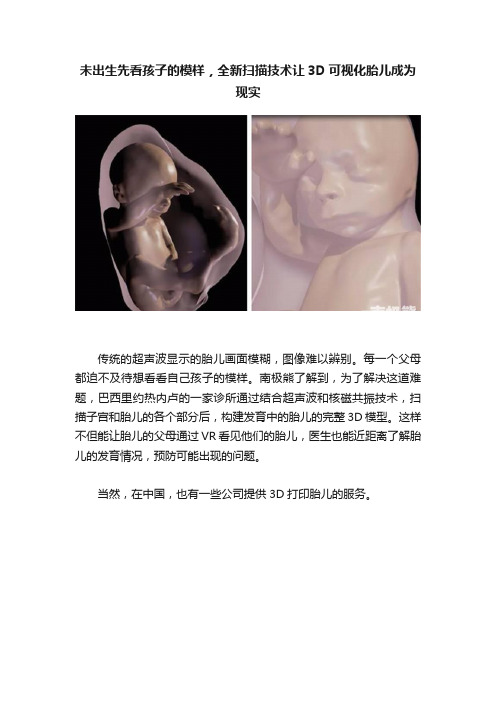 未出生先看孩子的模样，全新扫描技术让3D可视化胎儿成为现实