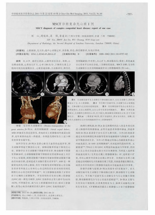 MSCT诊断复杂先心病l例