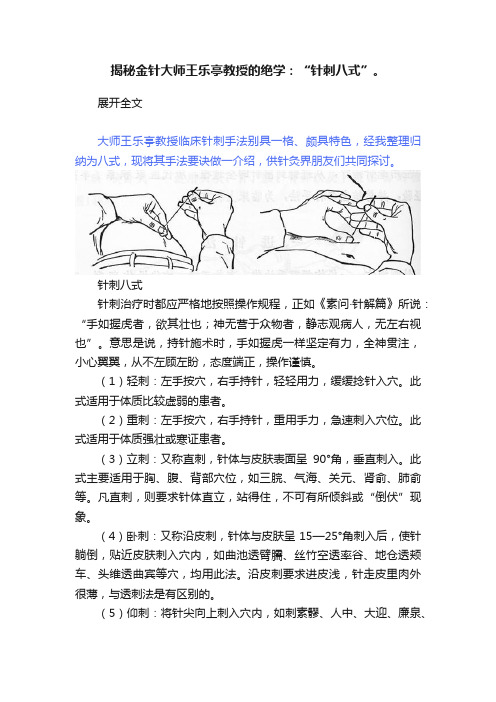 揭秘金针大师王乐亭教授的绝学：“针刺八式”。