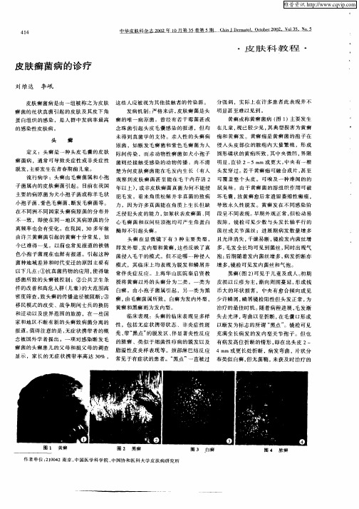 皮肤癣菌病的诊疗