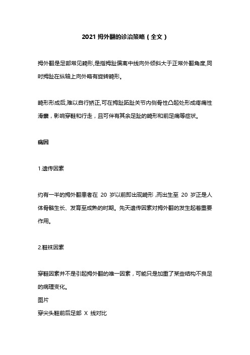 2021拇外翻的诊治策略(全文)